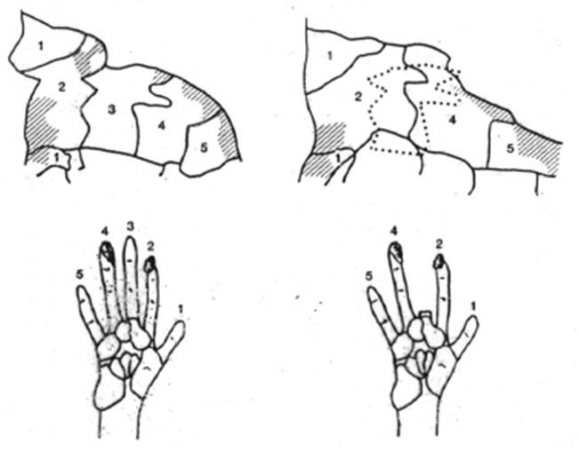 144
